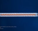 Abbott Vascular Esprit BTK resorbable stent | Used in Angioplasty | Which Medical Device